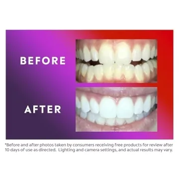 Colgate LED Teeth Whitening Kit - Enamel Safe Fast Results