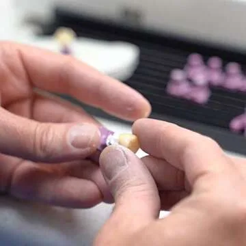 Perfect Pegs for All Restorations - Assortment of 12