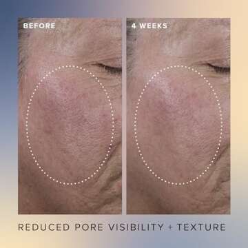 Farmacy Face Exfoliator Serum - Honey Glow 17% AHA + BHA Liquid Exfoliant and Salicylic Acid Serum - Resurfacing Serum for Reduced Pore Visibility + Texture - Hydrates Skin for an Overall Glow (30ml)