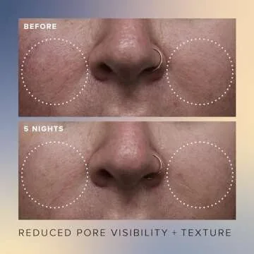 Farmacy Face Exfoliator Serum - Honey Glow 17% AHA + BHA Liquid Exfoliant and Salicylic Acid Serum - Resurfacing Serum for Reduced Pore Visibility + Texture - Hydrates Skin for an Overall Glow (30ml)