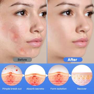 Breiboz Hydrocolloid Pimple Patches - 331 Size Varieties