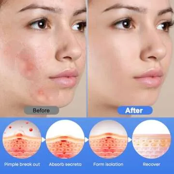 Breiboz Hydrocolloid Pimple Patches - 331 Size Varieties