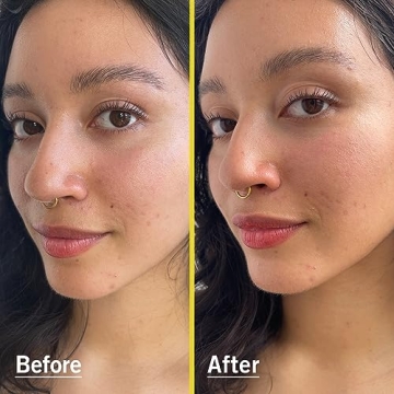 First Aid Beauty Lightweight Mineral Sunscreen SPF 30