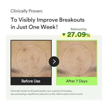 Abib Heartleaf Teca Capsule Serum Calming Drop 1.69 fl oz, Centella Asiatica & Niacinamide Serum for Soothing, Acne Treatment for Face, Korean Skin Care for Oily Skin