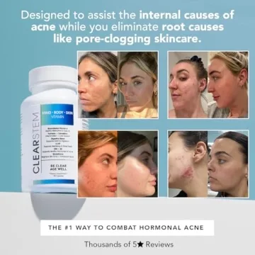 CLEARSTEM MINDBODYSKIN Natural Acne Supplement for Healthy Skin