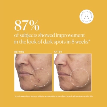 Naturium Tranexamic Acid 5% Serum for Radiant Skin