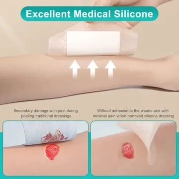 Dimora Silicone Foam Dressing - Effective Wound Care Solution