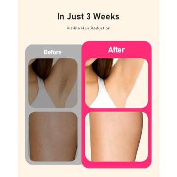 LYSMOSKI Laser Hair Removal for Women and Men, Long-Lasting IPL Hair Removal at-home, 5.2 cm² Contact Nearly Painless, Effective in 2 Weeks with Ultra-fast 0.12S Light Emission,8 Minute Whole Body