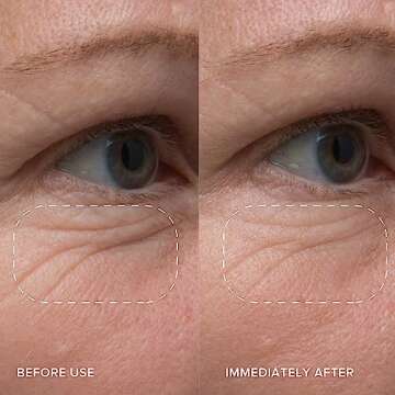 Alpyn Starter Skincare Set: Eye Balm, Cleanser & Moisturizer