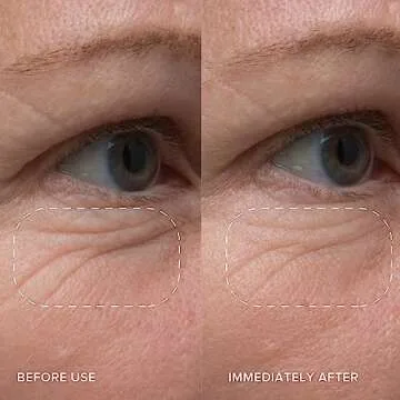 Alpyn Starter Skincare Set: Eye Balm, Cleanser & Moisturizer