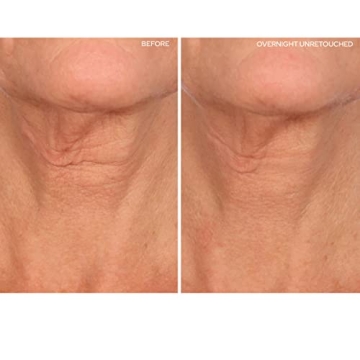 SiO Beauty Overnight Silicone Smoothing Patches