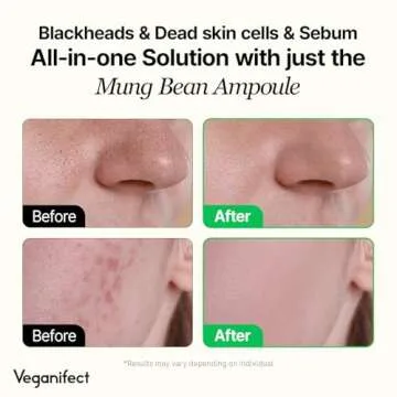 VEGANIFECT Mung Bean Serum, Enhancing Moisture Barrier, Gentle Exfoliation, for Glow Skin, Korean Skin Care, Vegan, 1.69 Fl Oz