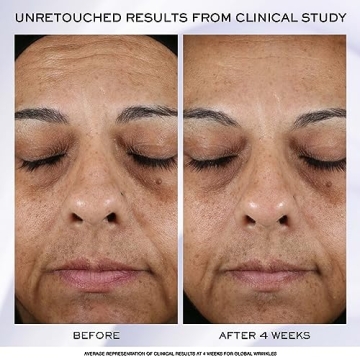 Lancôme Rénergie H.P.N Peptide Face Cream for Youthful Skin