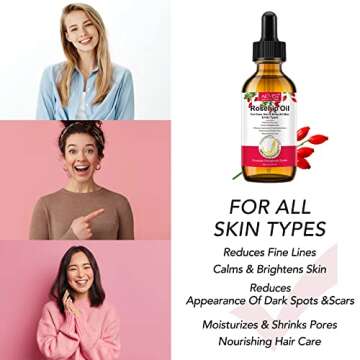 SUPSERSR Rosehip Oil, Organic Rosehip Seed Oil Anti-Aging Natural Cold Pressed Unrefined For Face, Hair, Nail, Scar, All Skin & Hair Types
