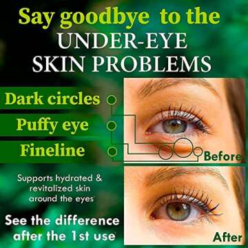 Arvesa Under Eye Patches - Eye Mask For Puffy Eyes And Dark Circles Reduce Wrinkles & Bags - Skin Treatment Pads Anti Aging Moisturizer Mask For Women Gift Eye Gel Pads