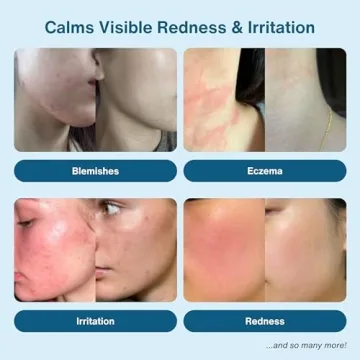 Honeydew Labs Hypochlorous Acid Spray for Sensitive Skin