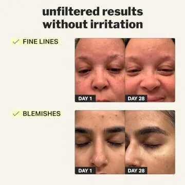 Cocokind Beginner Retinol Gel 0.1%, Improve the Appearance of Fine Lines and Uneven Texture without Irritation, Aloe and Cica to Prevent Dryness, 1 fl oz