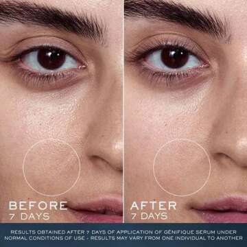 Lancôme Advanced Génifique Limited Edition Skincare Set - Full Size Serum 1.0 Fl Oz, Full Size Night Cream 1.7 Fl Oz & Full Size Cleanser 4.2 Fl Oz