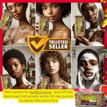 Premium African Black Soap - Pure 1 pound Bulk. Raw Organic Soap for Acne, Dry Skin, Rashes, Burns, Scar Removal, Face & Body Wash, From Ghana West Africa - Authentic African Moisturizer