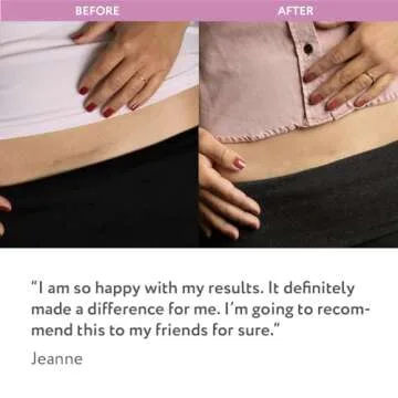 ScarAway Silicone Scar Sheets for C-Section Recovery