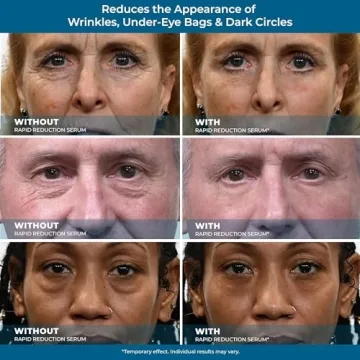 Plexaderm Eye Serum for Instant Wrinkle Reduction - Youthful Glow