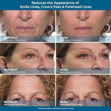 Plexaderm Eye Serum for Instant Wrinkle Reduction - Youthful Glow