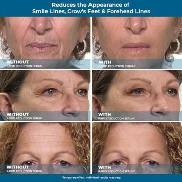 Plexaderm Eye Serum for Instant Wrinkle Reduction - Youthful Glow