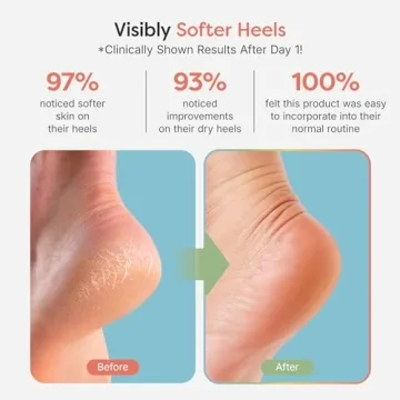 ZenToes Sleep Socks with Vitamin E for Dry Heels - 2 Pair