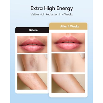 INNZA IPL Hair Removal Device with Ice Cooling Function