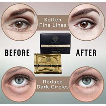 Luxury Gold Under Eye Patches for Dark Circles & Puffiness