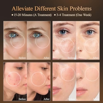 MEGELIN LED Light Therapy Mask for Skin Rejuvenation