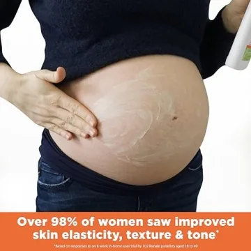 Palmer's Cocoa Butter Stretch Mark Lotion for Pregnancy