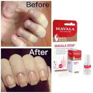 Mavala Stop Nail Polish Treatment for Healthy Nails