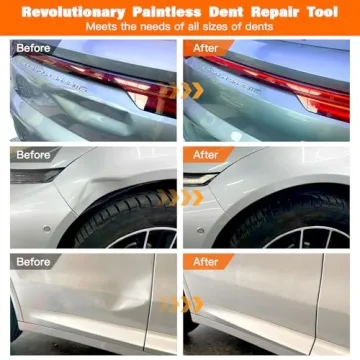 Dent Puller,Dent Removal Kit,3 Pack Car Dent Puller Kit Handle Lifter,Powerful Car Dent Remover,Dent Popper,Dent Fixer,Suction Cup Dent Puller And Paintless Dent Repair Kit For Car 3pcs