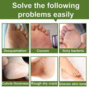 Alfea Foot Peel Mask 2 Pack for Soft Baby Feet