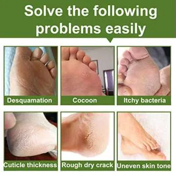 Alfea Foot Peel Mask 2 Pack for Soft Baby Feet