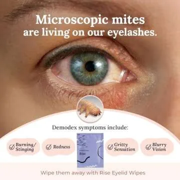 CorneaCare Rise: Eyelid Wipes | Eye Wipes for Dry Eyes | Eyelid Wipes with Tea Tree Oil & Hyaluronic Acid | Travel Ready | 30 Count | FSA & HSA Eligible