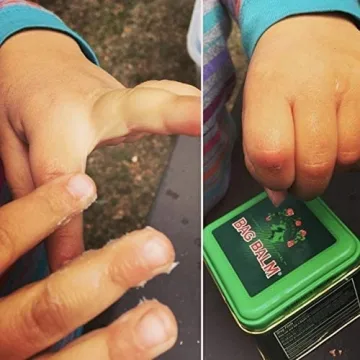 Bag Balm Skin Moisturizer - Full Body Hydrating Skin Care: Dry Hands, Lips, Face, Feet & More - Unscented, Cruelty & Paraben Free - Day & Night, Men & Women, Vermont's Original (4oz Tin, Made in USA)