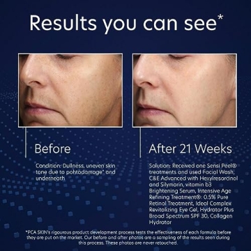 PCA SKIN Niacinamide Brightening Serum for Dark Spots