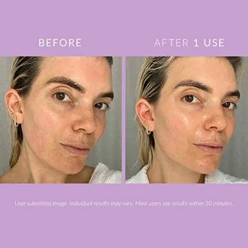 Hydrating Recovery Cream for Irritated Sensitive Skin