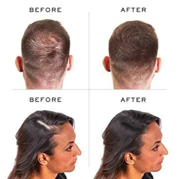 Nanogen Keratin Hair Fibers,, 30-grams, Black