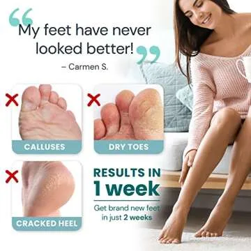 Foot Peel Exfoliating Mask (2 Pairs) for Soft Feet and Exfoliant Gel Peels Away Rough Dry Skin and Callus