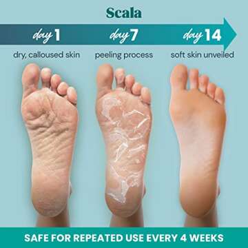 Foot Peel Exfoliating Mask (2 Pairs) for Soft Feet and Exfoliant Gel Peels Away Rough Dry Skin and Callus