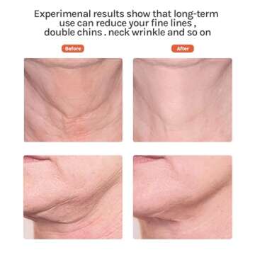 Ms.W Red Light Face Massager Tool, Facial Massager for Skin Care with LED, Heated, and Vibration,Tightenings and Rejuvenation for Face and Neck