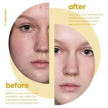 artnaturals Lactic Acid plus AHA Face Serum for Brightening Boost with Renewing Formula - Scars, Acne, Wrinkles - Exfoliates and Moisturizes the Skin - 1 oz.