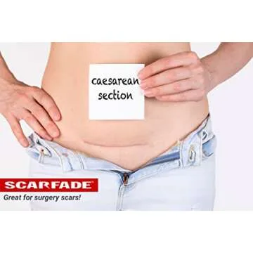 Vitamin C Scar Cream for Fading Scars - 0.5 oz