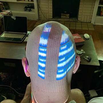 Spud v Cancer: Join the Fight Against Cancer Today