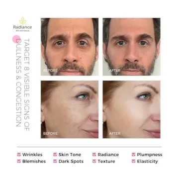 RADIANCE - Retinol Serum for Face with Vitamin E, Organic Jojoba Oil, Aloe Vera, Green Tea, Hylauronic Acid for Smoothing Fine Lines, Dark Spot & Anti Aging, Anti Wrinkles Facial Serum 1 Oz