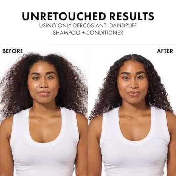 Dercos Moisturizing Conditioner for Hair & Scalp Care