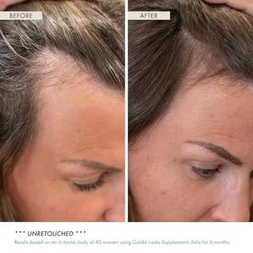 Goldie Locks Hair Growth Supplements Original Formula Refill, Hair Supplements for Stronger & Healthier Locks, Vitamins that Enhance Hair, Skin, and Nails, 120 Count